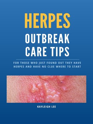 cover image of Herpes Outbreak Care Tips